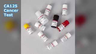 اختبار ELISA CA125 لرصد السرطان