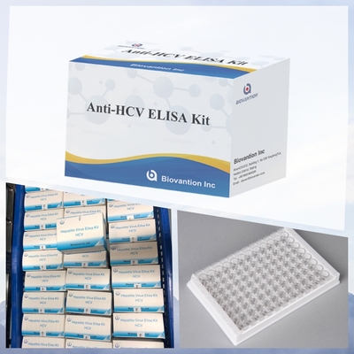 طقم اختبار مقايسة الامتصاص المناعي المرتبط بالإنزيم (ELISA) الجديد للوافدين لفيروس التهاب الكبد الوبائي سي (HCV) للاستخدام التشخيصي البشري في المستشفيات والعيادات والمختبرات