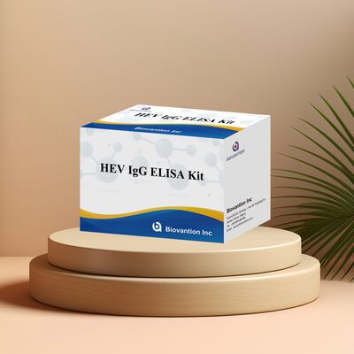مجموعة اختبار مقايسة الامتصاص المناعي المرتبط بالإنزيم (ELISA) عالية الحساسية لكشف الأجسام المضادة من نوع IgG لفيروس التهاب الكبد E بحجم 96 اختبارًا ومدة صلاحية 18 شهرًا لتشخيص التهاب الكبد E