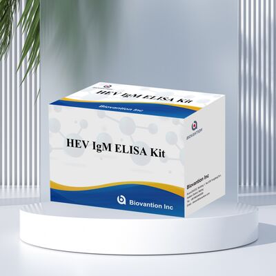 مجموعة اختبار ELISA لـ IgM لفيروس التهاب الكبد الوبائي (HEV) عالي الحساسية بحجم 96T ووقت فحص من ساعتين إلى 3 ساعات للتشخيص الدقيق