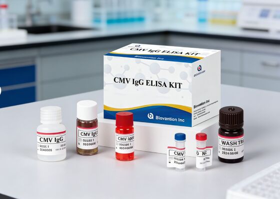 مجموعة اختبار CMV IgG Elisa عالية الدقة للمختبر أو المستشفى