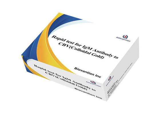 كاسيت اختبار سريع لـ CBV-IgG لعينات WB/S/P مع وقت قراءة 5-15 دقيقة