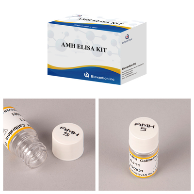 مجموعة اختبار Elisa AMH لتحليل هرمون AMH المناعي