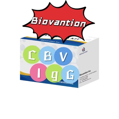 مجموعة التشخيص لـ CBV-IgG مجموعة اختبار ELISA المضادة للجسم اختبار المصل