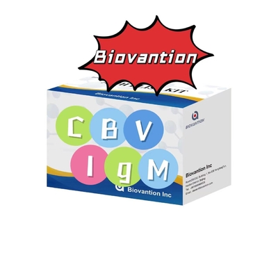 مجموعة التشخيص للجسم المضاد IgM لـ CBV مجموعة اختبار Elisa 50μL مصل التشخيص الطبي