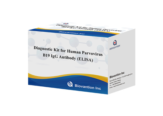 الأجسام المضادة لفيروس البارفوفيروس البشري B19 IgM مجموعة اختبار ELISA مجموعة تشخيص