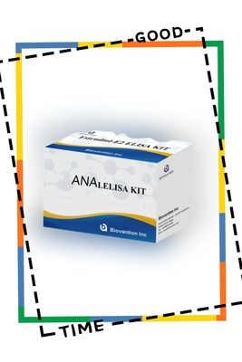 مجموعة اختبار ELISA ضد ANA IgG الكشف النوعي عن أجسام مضادة IgG النووية
