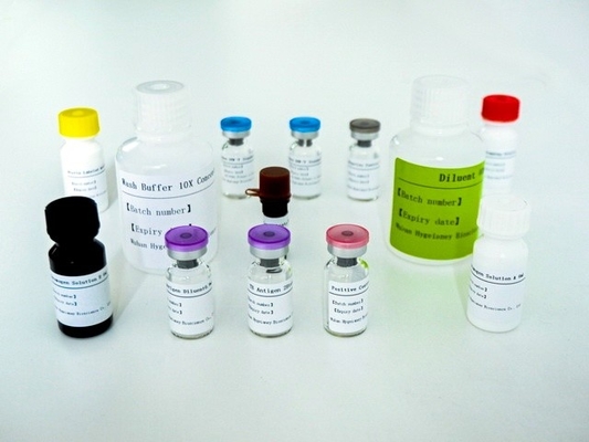 مجموعة اختبار الـ IGRA Elisa المتقدمة لـ TB للكشف الحساس والمتخصص عن المضادات