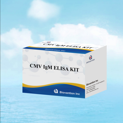 اختبار ELISA النوعي لـ Macrophage IgM مجموعة تجريبية IVD حساسية عالية