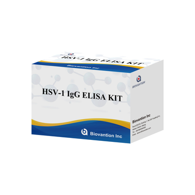 مجموعة اختبار الإمتحانات المناعية لـ HSV-1 IgG ذات الحساسية العالية للكشف عن المصل نوع عينة البلازما
