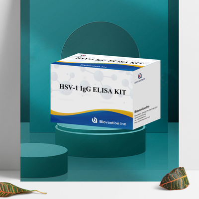 مجموعة اختبار الإمتحانات المناعية لـ HSV-1 IgG ذات الحساسية العالية للكشف عن المصل نوع عينة البلازما