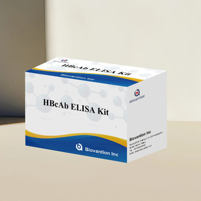 مجموعة اختبار HBcAb ELISA مجموعة اكتشاف الأجسام المضادة النوعية