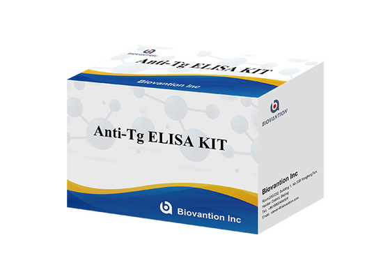مجموعة اختبار ELISA لمكافحة Tg Thyroglobulin Ab in Vitro