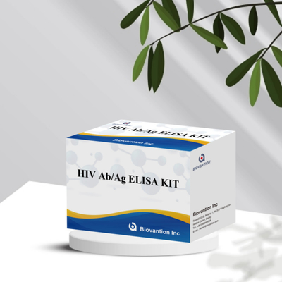 المفاعل IVD HIV Ab Ag Elisa أدوات الاختبار حساسية عالية / خصائص