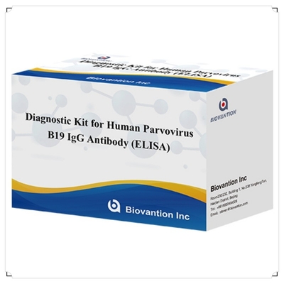 مجموعة التشخيص للاستخدام البشري للفيروس البارفوفيروسي البشري B19 IgM مجموعة اختبار Elisa مع 96T