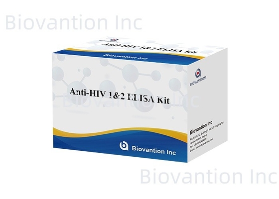 Biovantion مجموعة اختبار ELISA لمكافحة فيروس نقص المناعة البشرية الجيل الرابع لاختبار فيروس نقص المناعة البشرية 1 و 2