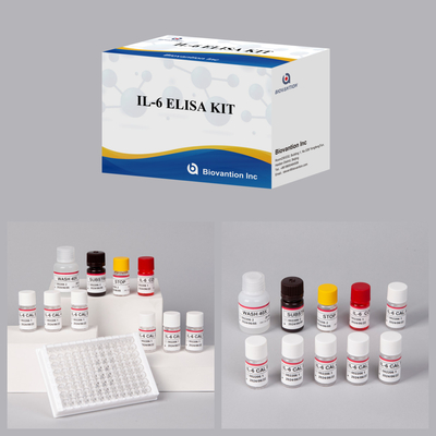 IL6 إنترلوكين-6 للإنسان Elisa Detect Reagent Elisa Analyzer البحث