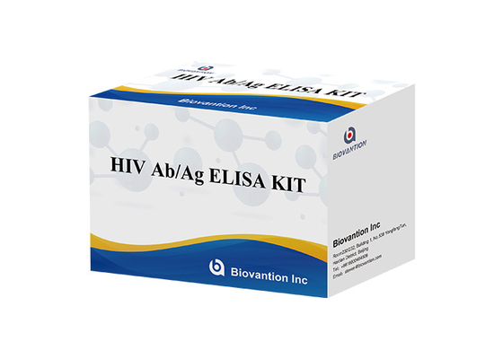 مجموعة اختبار ELISA لمضادات الجسم / المضادات المضادة لفيروس نقص المناعة البشري