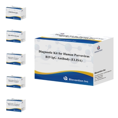 مجموعة التشخيص لـ parvovirus البشري B19 IgM ELISA المضادة للجسم المثالي لـ erythema Infectiosum والمضاعفات في الحمل