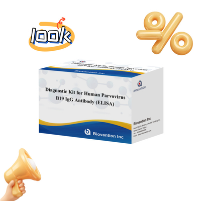 مجموعة التشخيص لـ parvovirus البشري B19 IgM ELISA المضادة للجسم المثالي لـ erythema Infectiosum والمضاعفات في الحمل