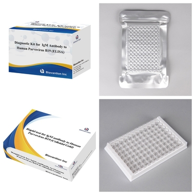 مجموعة التشخيص لـ parvovirus البشري B19 IgM ELISA المضادة للجسم المثالي لـ erythema Infectiosum والمضاعفات في الحمل