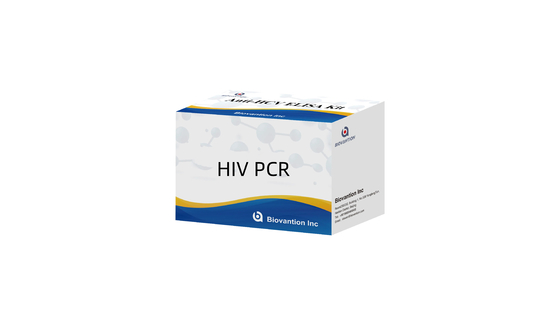 مجموعة RT-PCR الكمية لفيروس نقص المناعة البشرية 1 في المصل البشري أو البلازما بواسطة طريقة RT-PCR في الوقت الحقيقي