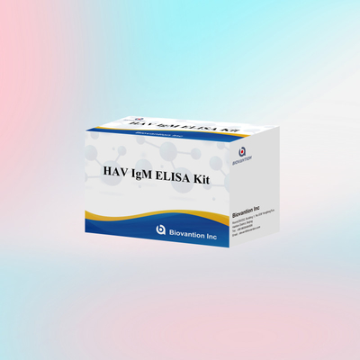HAV IgM ELISA Kit حساسية عالية التهاب الكبد A الكشف عن الفيروس اختبار تشخيصي دقيق موثوق به للمختبرات السريرية
