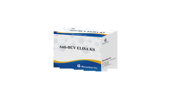 الكشف عن الأجسام المضادة لفيروس الكبد الكبرى باستخدام Biovantion Elisa Test Kit 96 اختبار في 2-3 ساعات