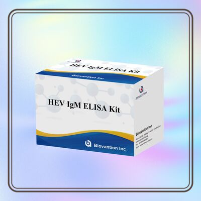 مجموعة اختبار ELISA لـ IgM لفيروس التهاب الكبد الوبائي (HEV) عالي الحساسية بحجم 96T ووقت فحص من ساعتين إلى 3 ساعات للتشخيص الدقيق
