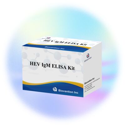 مجموعة اختبار ELISA لـ IgM لفيروس التهاب الكبد الوبائي (HEV) عالي الحساسية بحجم 96T ووقت فحص من ساعتين إلى 3 ساعات للتشخيص الدقيق