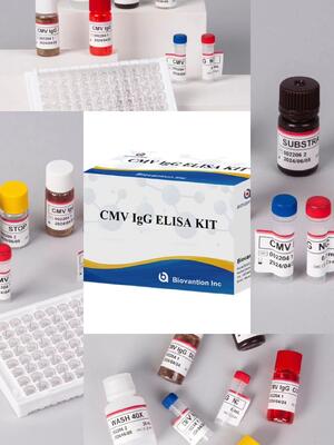 مجموعة اختبار CMV IgG Elisa عالية الدقة للمختبر أو المستشفى