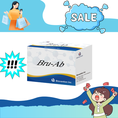 مجموعة اختبار ELISA لمضادات الكريات البروسيلا البشرية IgG/IgM للكشف عن العينة البشرية